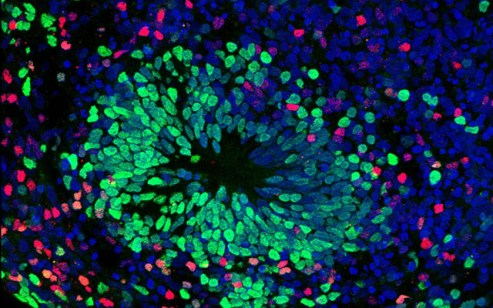 organoids_layer_muotri